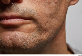  Photos Gabriel Ocampo HD Face skin references lips mouth pores skin texture 0005.jpg